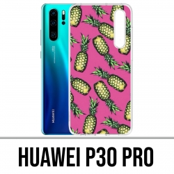 Coque Huawei P30 PRO - Ananas